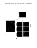 TREATMENT OF TUMORS BY ABLATING BONE MARROW-DERIVED ENDOTHELIAL PROGENITOR CELLS diagram and image