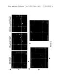 TREATMENT OF TUMORS BY ABLATING BONE MARROW-DERIVED ENDOTHELIAL PROGENITOR CELLS diagram and image