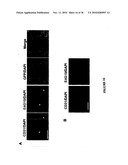 TREATMENT OF TUMORS BY ABLATING BONE MARROW-DERIVED ENDOTHELIAL PROGENITOR CELLS diagram and image