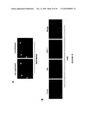 TREATMENT OF TUMORS BY ABLATING BONE MARROW-DERIVED ENDOTHELIAL PROGENITOR CELLS diagram and image