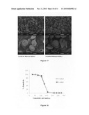 Erythrocyte-encapsulated L-asparaginase for enhanced acute lymphoblastic leukemia therapy diagram and image