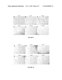 Phospholipase C and Method of Use diagram and image