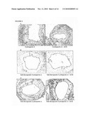 Immunosuppressive Extract Of Cordyceps Sinensis And Uses Thereof diagram and image