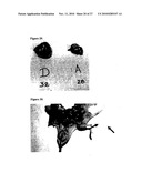 SHORT NUCLEIC ACID MOLECULE-MEDIATED MODULATION OF AURORA B KINASE EXPRESSION AND COMBINATIONS FOR USE IN ANTICANCER THERAPY diagram and image