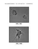 COMPOSITIONS COMPRISING NANOPARTICLES AND APOPTOTIC AGENTS AND METHODS OF USE diagram and image