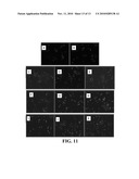 COMPOSITIONS COMPRISING NANOPARTICLES AND APOPTOTIC AGENTS AND METHODS OF USE diagram and image