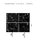 ANTIMICROBIAL AGENT FOR GRAM-POSITIVE BACTERIA diagram and image