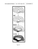 Neurofibrillary labels diagram and image