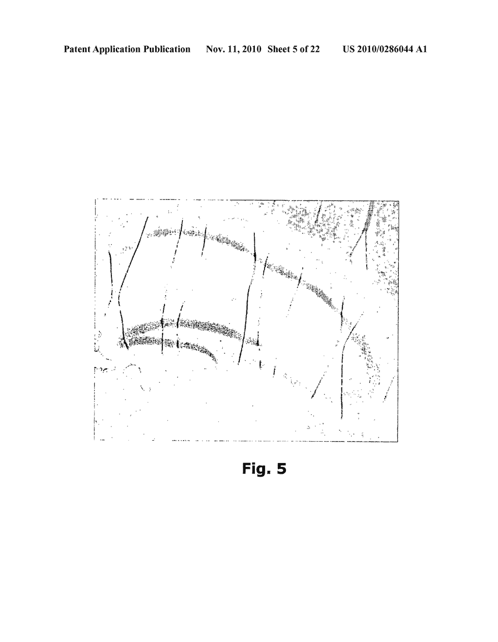 DETECTION OF TISSUE ORIGIN OF CANCER - diagram, schematic, and image 06