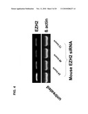 PRO-ANGIOGENIC GENES IN OVARIAN TUMOR ENDOTHELIAL CELL ISOLATES diagram and image