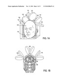 TRANSCRANIAL MAGNETIC STIMULATION FIELD SHAPING diagram and image