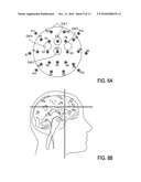 TRANSCRANIAL MAGNETIC STIMULATION FIELD SHAPING diagram and image