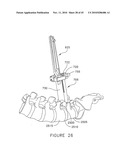 PEDICLE GUIDED RETRACTOR SYSTEM diagram and image