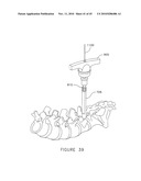 PEDICLE GUIDED RETRACTOR SYSTEM diagram and image