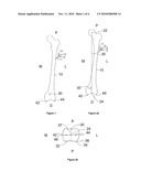 TOOL FOR DETECTING PLANES OF A BONE AND ASSIGNED DATA PROCESSING METHOD diagram and image