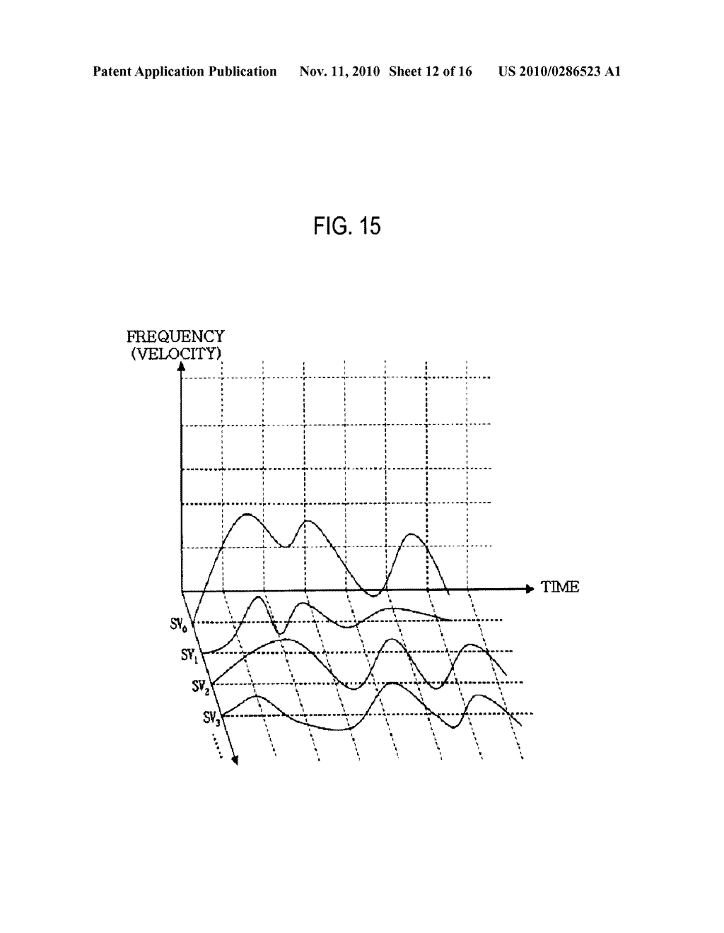 ULTRASOUND DIAGNOSTIC SYSTEM AND METHOD FOR DISPLAYING DOPPLER SPECTRUM IMAGES OF MULTIPLE SAMPLE VOLUMES - diagram, schematic, and image 13