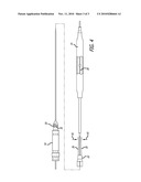 CATHETER PUSH DEVICE diagram and image