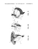 Systems and Methods for Prostate Treatment diagram and image