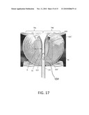 Systems and Methods for Prostate Treatment diagram and image