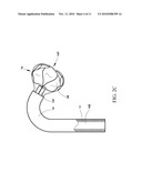 Device and method for fragmenting and removing concretions from body ducts and cavities diagram and image