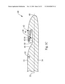 VALVULOTOME DEVICE AND METHOD diagram and image