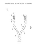 VALVULOTOME DEVICE AND METHOD diagram and image