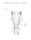 VALVULOTOME DEVICE AND METHOD diagram and image