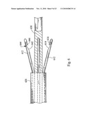 VALVULOTOME DEVICE AND METHOD diagram and image