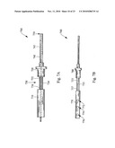 VALVULOTOME DEVICE AND METHOD diagram and image