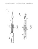 VALVULOTOME DEVICE AND METHOD diagram and image