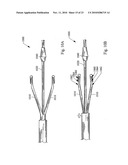 VALVULOTOME DEVICE AND METHOD diagram and image