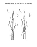 VALVULOTOME DEVICE AND METHOD diagram and image