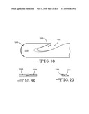 VALVULOTOME DEVICE AND METHOD diagram and image