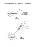 TISSUE PUNCTURE CLOSURE DEVICE WITH ACTUATABLE AUTOMATIC SPOOL DRIVEN COMPACTION SYSTEM diagram and image