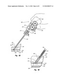 TISSUE PUNCTURE CLOSURE DEVICE WITH ACTUATABLE AUTOMATIC SPOOL DRIVEN COMPACTION SYSTEM diagram and image