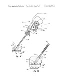 TISSUE PUNCTURE CLOSURE DEVICE WITH ACTUATABLE AUTOMATIC SPOOL DRIVEN COMPACTION SYSTEM diagram and image