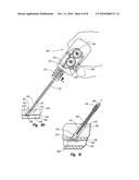 TISSUE PUNCTURE CLOSURE DEVICE WITH ACTUATABLE AUTOMATIC SPOOL DRIVEN COMPACTION SYSTEM diagram and image