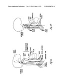 CARDIAC RHYTHM MANAGEMENT DEVICE WITH NEURAL SENSOR diagram and image