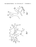 CARDIAC RHYTHM MANAGEMENT DEVICE WITH NEURAL SENSOR diagram and image