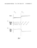 CARDIAC RHYTHM MANAGEMENT DEVICE WITH NEURAL SENSOR diagram and image