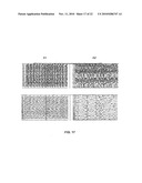 METHODS FOR APPLYING BRAIN SYNCHRONIZATION TO EPILEPSY AND OTHER DYNAMICAL DISORDERS diagram and image