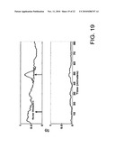 METHODS FOR APPLYING BRAIN SYNCHRONIZATION TO EPILEPSY AND OTHER DYNAMICAL DISORDERS diagram and image