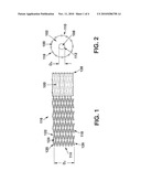 Implantable Temporary Flow Restrictor Device diagram and image