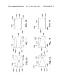 Implantable Temporary Flow Restrictor Device diagram and image