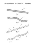 MEDICAL DEVICE SUITABLE FOR LOCATION IN A BODY LUMEN diagram and image