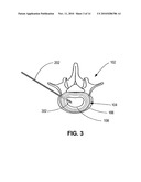 BIOADHESIVE HYDROGELS diagram and image