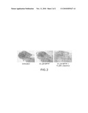 Transgenic Zebrafish Models for Neurodegenerative Diseases diagram and image