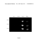 PROTEIN EXPRESSION SYSTEM diagram and image