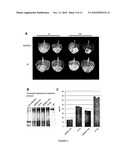 PROTEIN EXPRESSION SYSTEM diagram and image