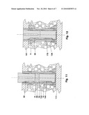 Cement anchor of lightweight construction panels diagram and image